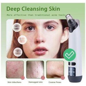 Image demonstrating the blackhead remover vacuum in action, effectively performing deep facial cleansing and blackhead removal