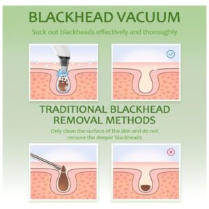 The blackhead remover vacuum tool displayed with its various features and accessories for skin care treatments.